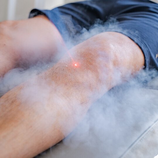 Cryospot